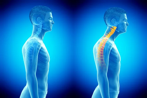 Body Alignment