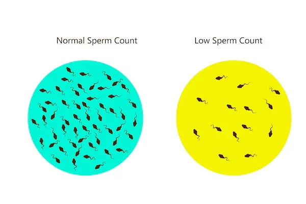 Low or Zero Sperm Count